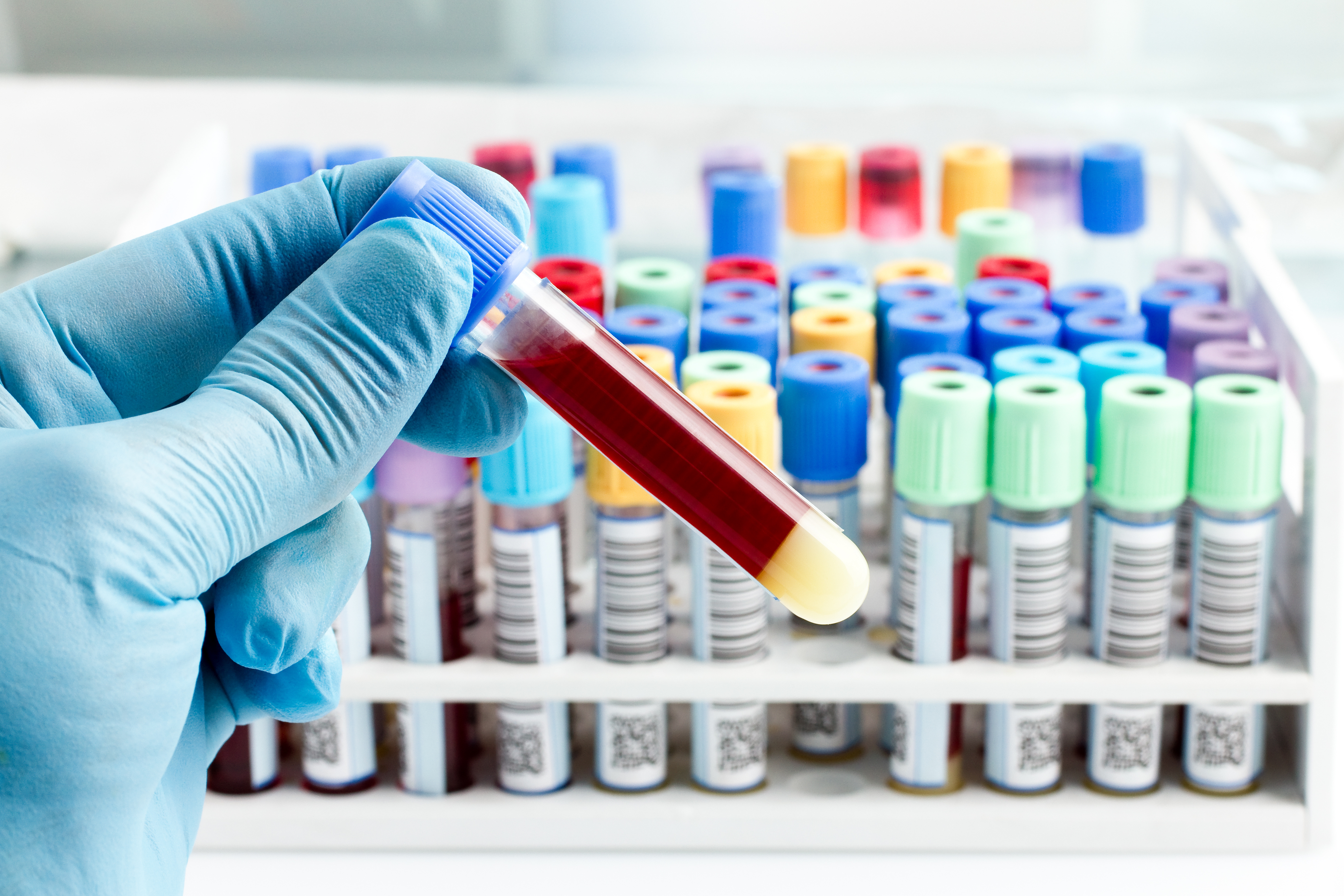 laboratory-testing-at-lane-regional-medical-center-types-of-blood-work